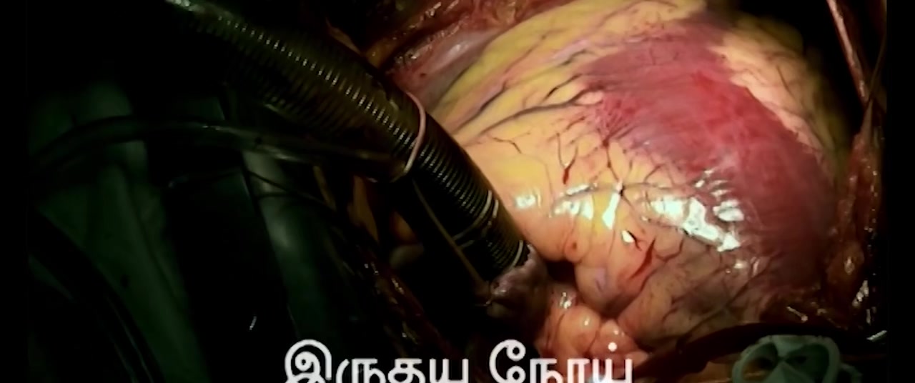 isaimini.Tube - Boomi Enna Suthuthey 2024 Original 720p HD (800MB).mp4